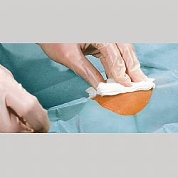 FOLIODRAPE PROTECT ΧΕΙΡΟΥΡΓΙΚΑ ΠΕΔΙΑ ΑΠΟΣΤΕΙΡΩΜΕΝΑ ΜΕ ΟΠΗ 7cm ΚΑΙ ΑΥΤΟΚΟΛΛΗΤΟ 75x90cm 40τεμ.